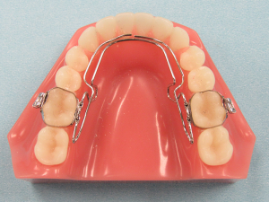 3d_Wilson_QUAD-ACTION_Fixed_Dental_Appliance-300x225