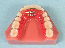 dr robert schwartz orthodontics