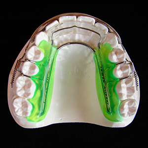 inman-aligner-2