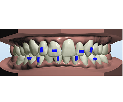 ATTACHMENTS_2